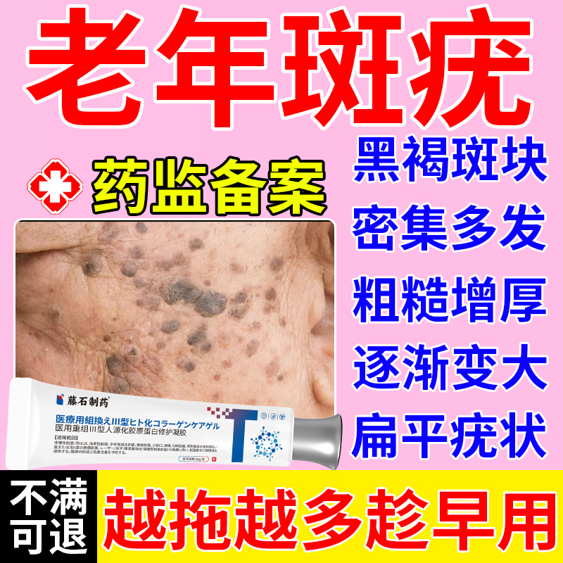 【现货速发】老年斑疣扁平疣去除