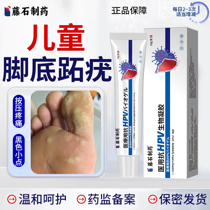 【医用级】儿童脚底跖疣图片