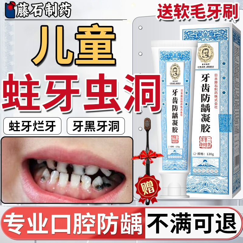 【不满可退】儿童蛀牙牙洞清理