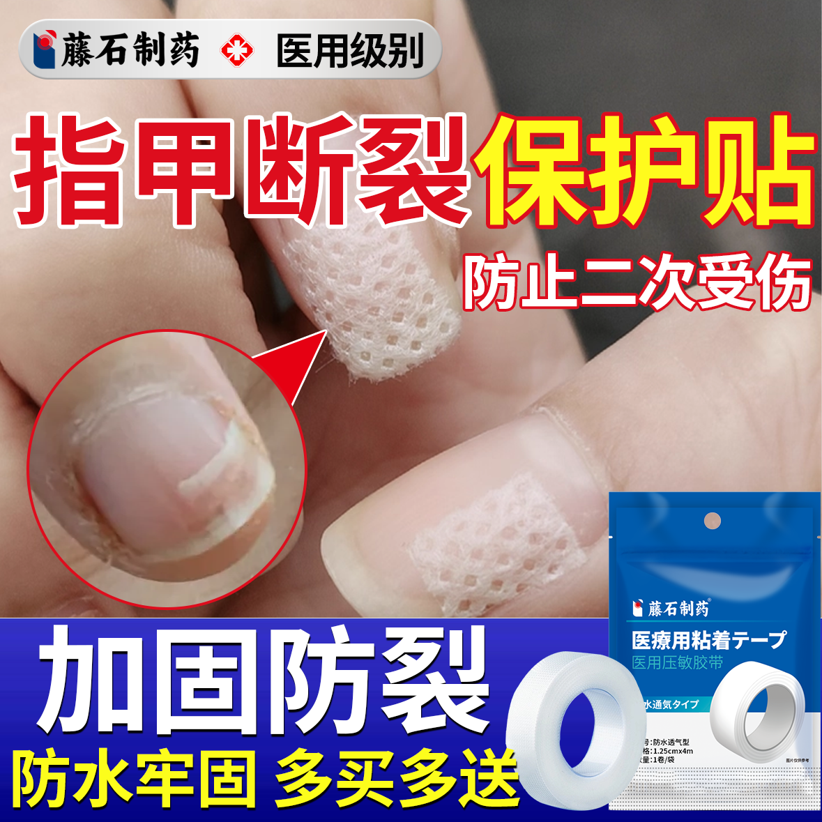 指甲劈了医用指甲断裂开裂保护贴劈裂护甲指甲盖受伤断甲保护套OZ