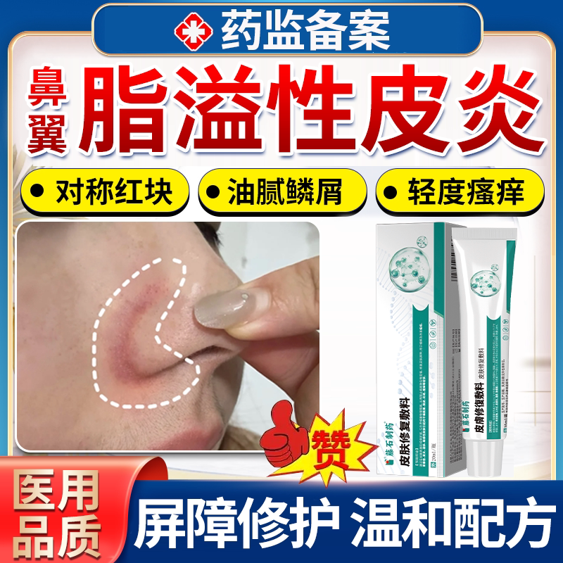 藤石制药】鼻翼两侧脂溢性皮炎