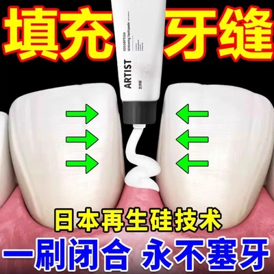 牙缝宽大修复神器补牙缝填充门牙牙缝大矫正防堵蛀牙牙洞清理