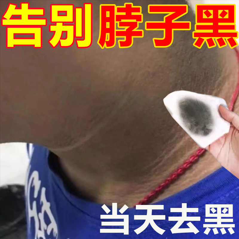 脖子黑色素去除黑色素沉淀儿童成人脖子黑棘皮洗不干净黑脖子神器