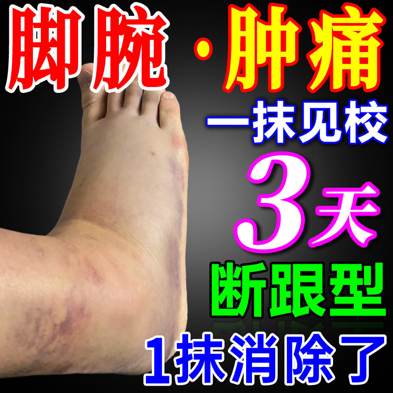 脚踝受伤走路神器崴脚扭伤脚踝热敷脚腕疼痛韧带拉伤恢复专用药膏