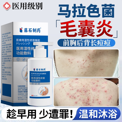 【医用级】马拉色菌毛囊炎沐浴液