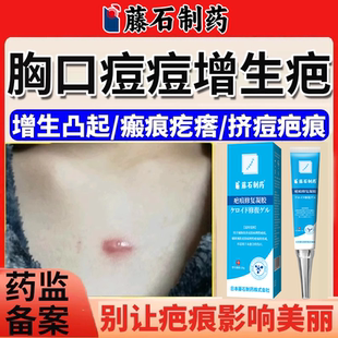 胸口前痘印痘痘增生疤痕凸起疙瘩硬肉去除医祛疤膏瘢痕贴EM