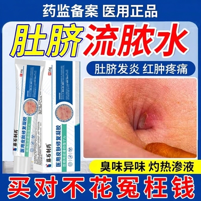 【肚脐发炎】肚脐眼红肿热痛