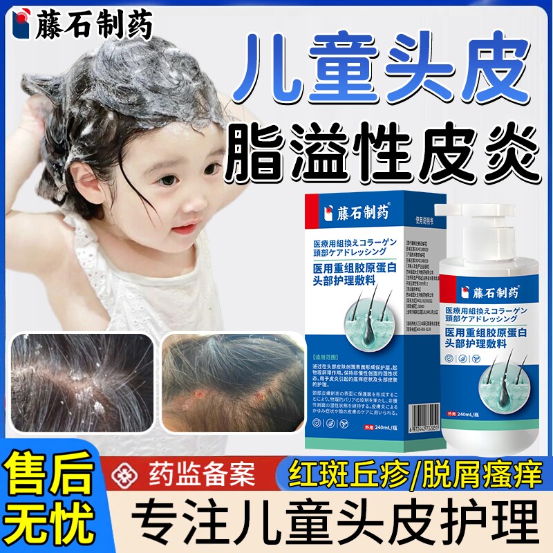 儿童头皮脂溢性皮炎毛囊炎洗发水去屑止痒抑菌真菌感染头癣喷剂EM