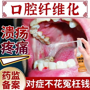 口腔白斑黏膜纤维化修复液专用戒槟榔神器溃疡张不开嘴药房同售BS