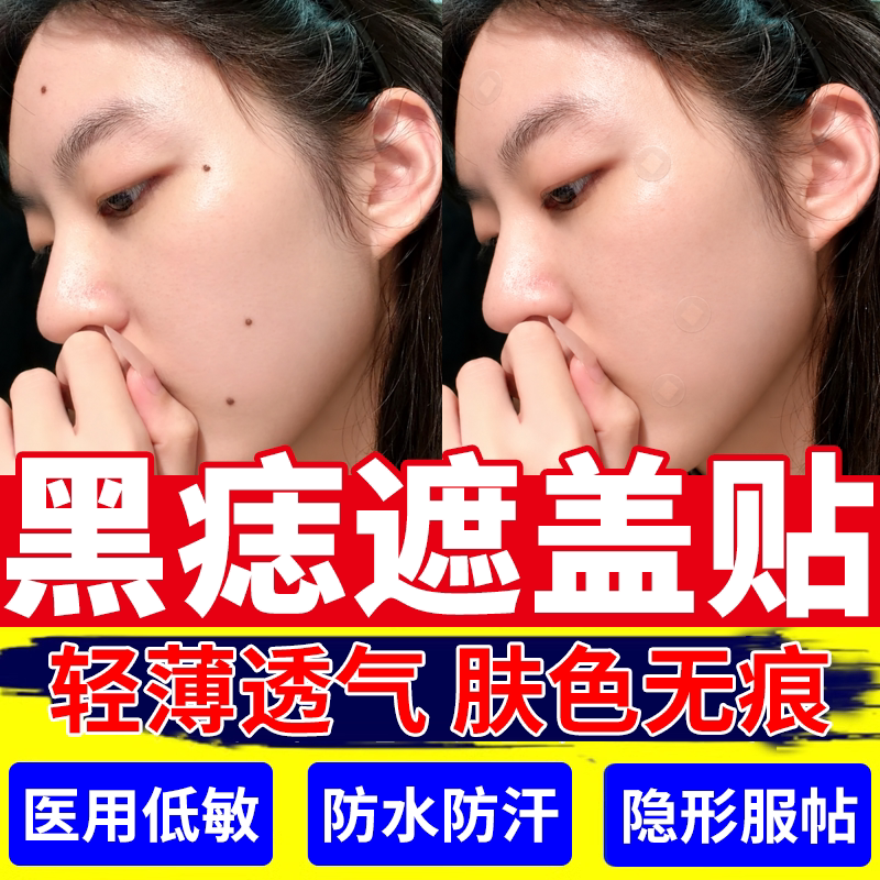 黑痣遮盖遮凸痦子隐形贴低敏透气