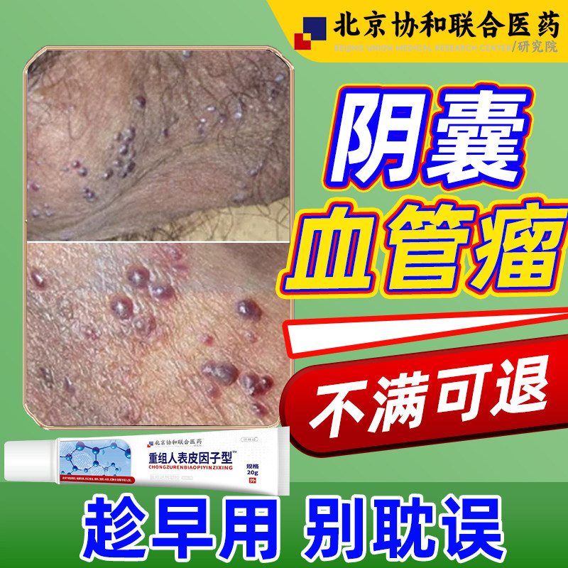 阴囊血管角化瘤红黑疙瘩专用血管痣去除樱桃状凝胶蜘蛛痣湿疹膏nk