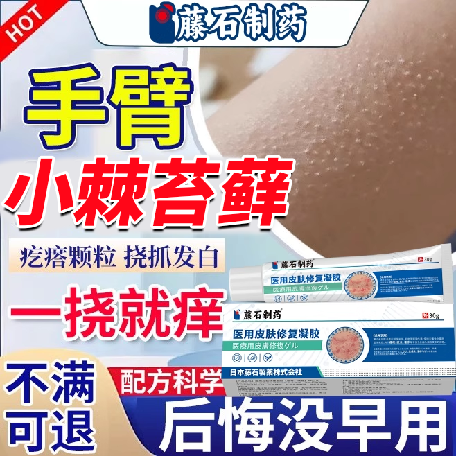 小棘苔藓胳膊上的小疙瘩颗粒手臂腿部毛囊炎专用儿童鸡皮疙瘩痒OZ