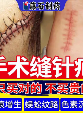 【藤石制药】手术缝针疤痕修复