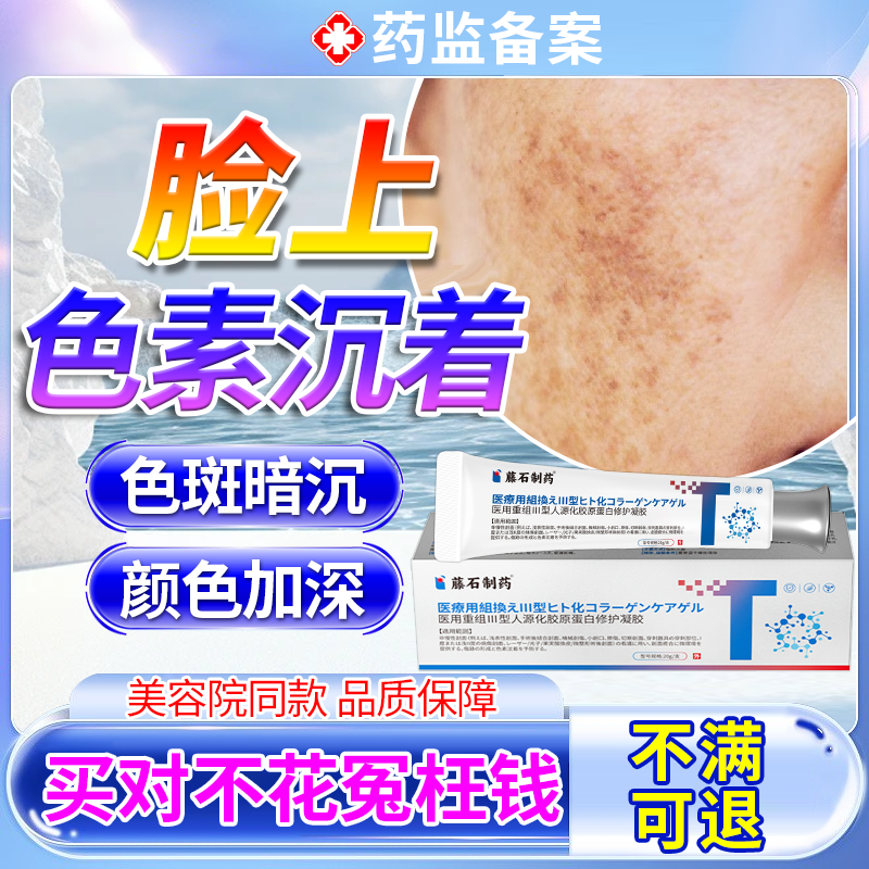 痘印黑色素沉淀去除面部淡化脸上疤痕黑印烟酰胺雀斑搭面霜JW