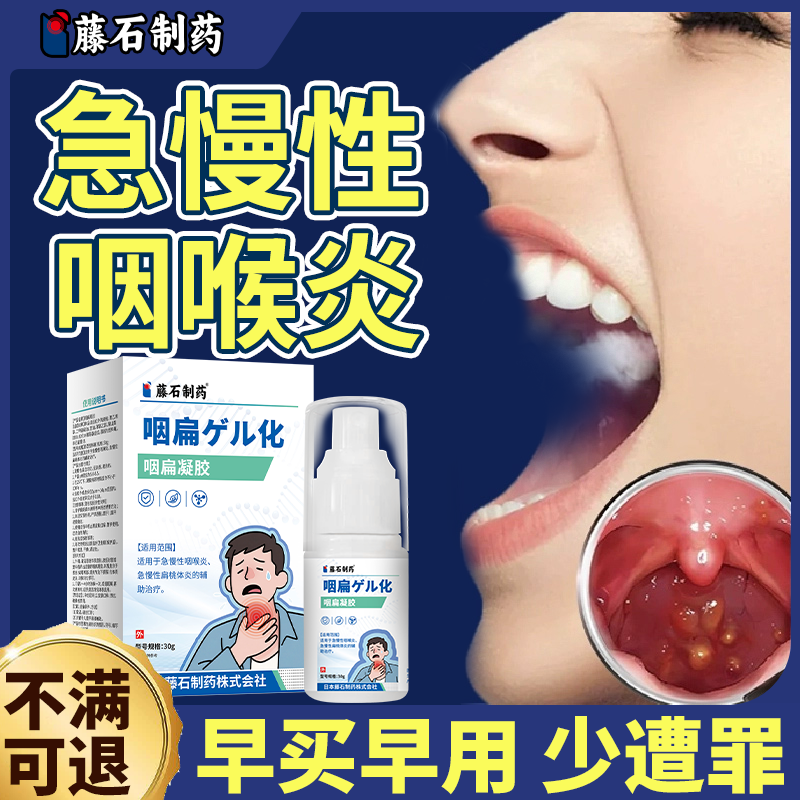 会厌囊肿咽喉炎异物感有痰声带小结息肉 滤泡增生搭喷雾剂去除EM