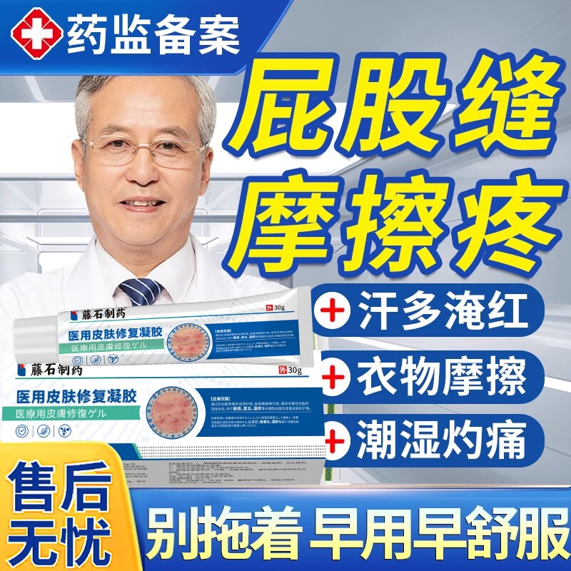 屁股缝摩擦疼胖人夏天出汗多防烧裆屁股沟潮湿瘙痒屁眼肛湿门疹EM