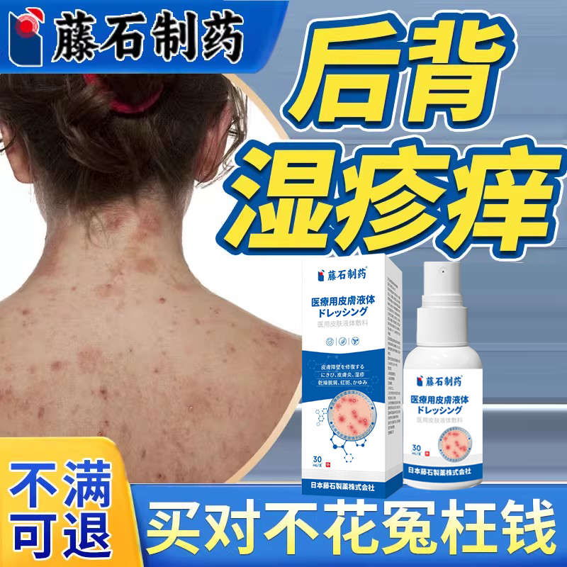 后背皮肤湿疹止痒去顽固皮炎真菌感染根喷雾喷剂热毒专用除湿膏DZ
