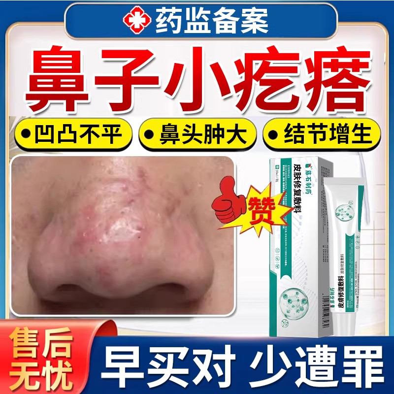 鼻头增生鼻子长疙瘩鼻尖小疤痕痘痘皮脂腺增生肉疤痕硬凸起去除DZ