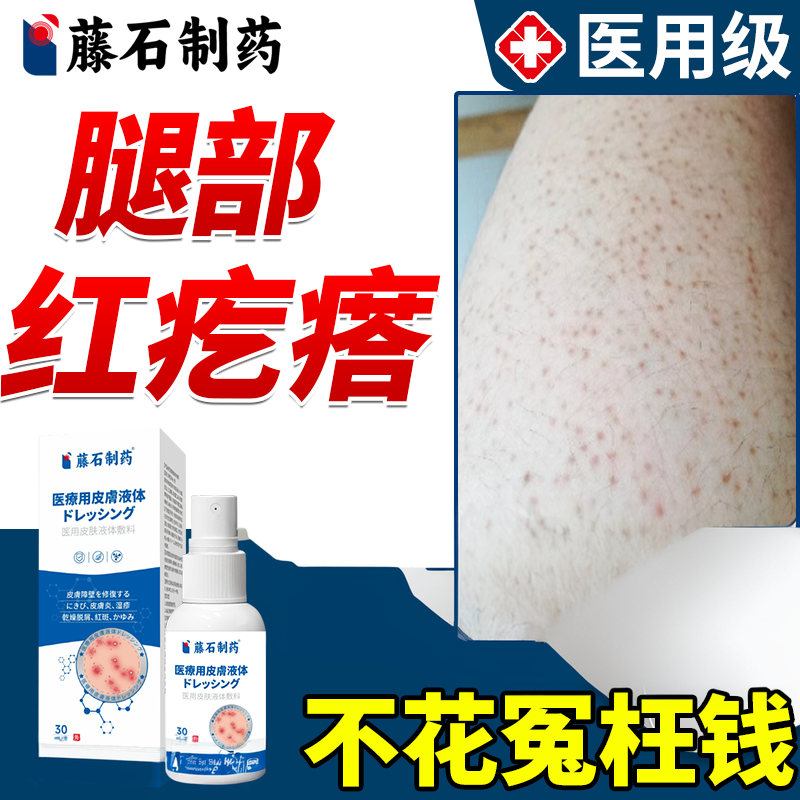 腿部毛囊炎喷剂大腿上长红疙瘩红疹小痘痘毛周角化症鸡皮肤OZ