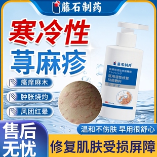 藤石制药寒冷性寻荨麻疹皮肤过敏断止痒根专特用效提高免疫力慢EM