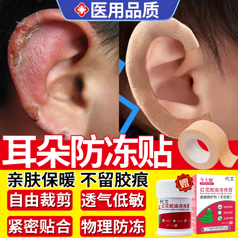 冬天耳朵防冻贴防冻神器儿童暖贴女生宝宝冻疮贴防耳朵冻疮保暖OZ,医疗器械,医用胶带,淘宝优惠券,粉丝福利购,淘宝优惠卷