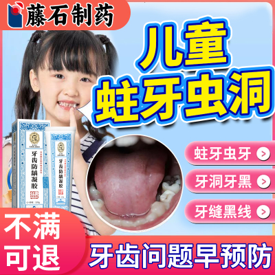 现货速发儿童蛀牙洞清理蚜虫修复