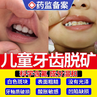 儿童牙齿脱矿防白斑钙化再矿化护牙素修复含氟非牙膏专用牙釉质JW