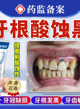 牙齿酸蚀牙根腐蚀变黑脱矿釉质楔状缺损修黑斑去除复含氟搭牙膏JW