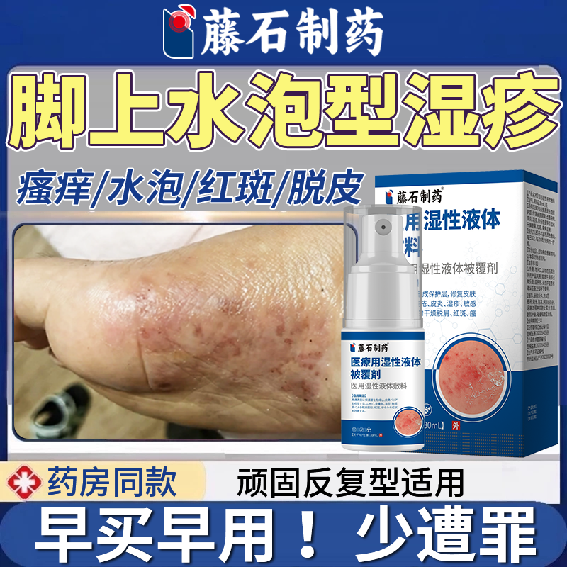 脚背脚底上长起小水泡湿疹汗泡疹止痒去又痒又脱皮药房同款膏根QF