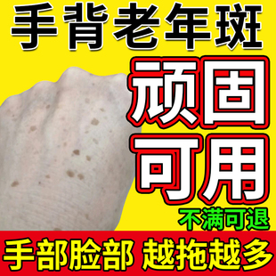 藤石制薬手背手上的老年斑专用强力扁平疣去除手部一抹脸部净膏DZ