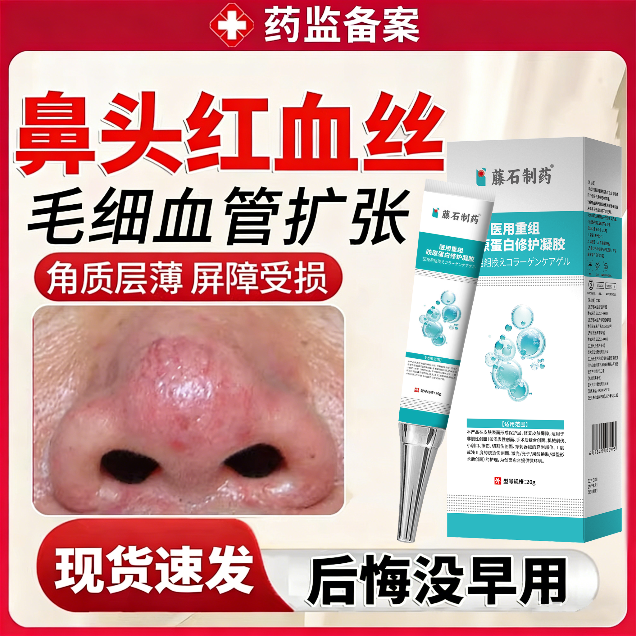 鼻子红血丝去除鼻头修护修复增厚角质层改善敏感肌肤去脸部泛红JW