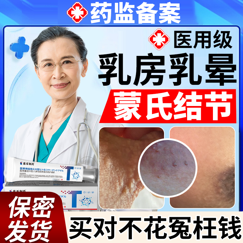 乳晕小疙瘩乳房乳晕蒙氏结节乳头瘙痒发炎周边小颗粒乳腺结节膏EM