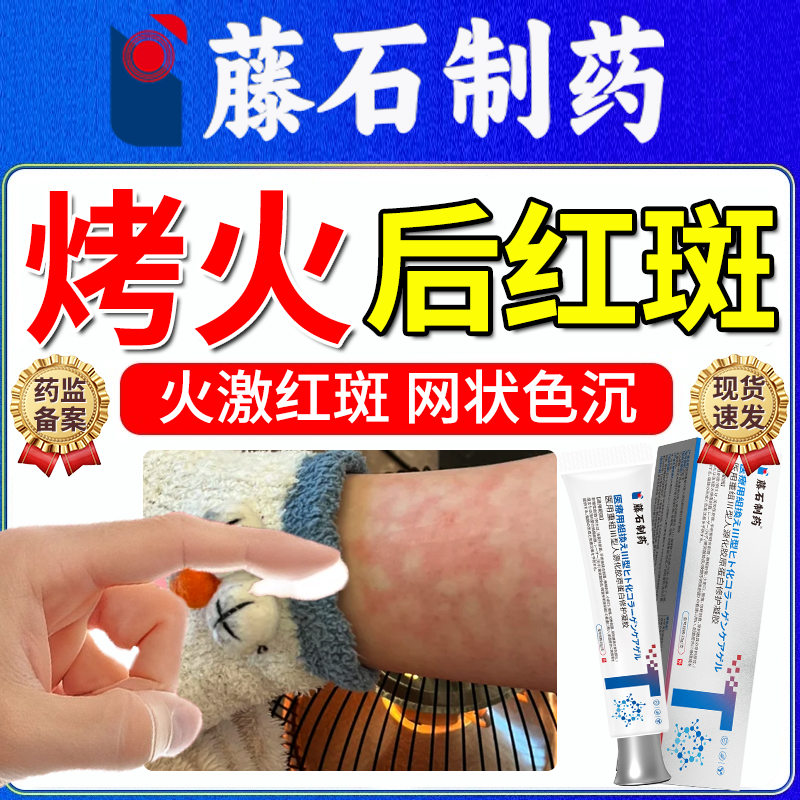 火激红斑】重组人源胶原蛋白凝胶