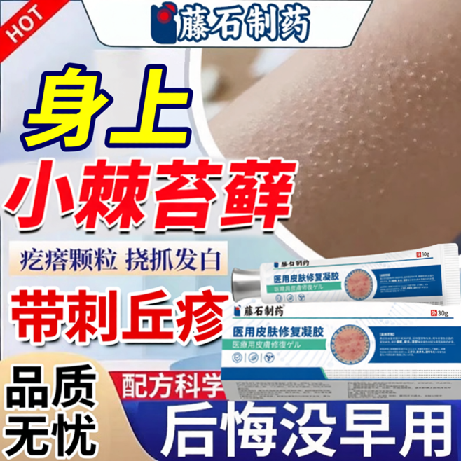 小棘苔藓胳膊上的小疙瘩颗粒手臂腿部毛囊炎专用儿童鸡皮疙瘩痒OZ