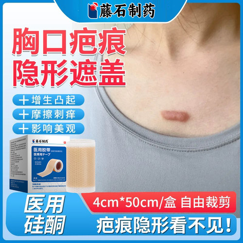 胸口疤痕遮盖隐形贴医用硅凝胶