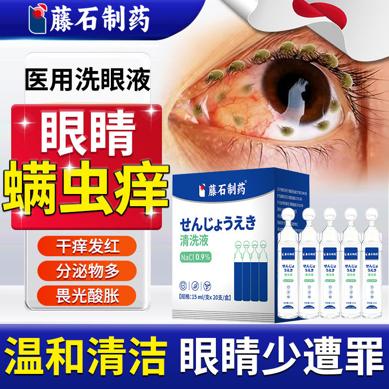 眼睛螨虫干痒洗眼液一次性生理盐水可搭除螨眼药水湿巾用医用级TU