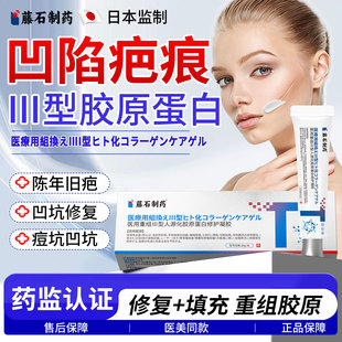 凹陷性疤痕修复填充生长因子医用重组三型人源化胶原蛋白凝胶YZ