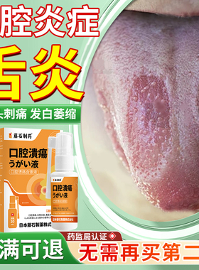 舌炎舌头专用喷雾药房同款裂纹有齿痕舌康灵白苔厚裂痕灼伤上火YY