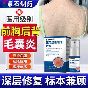 前胸后背背上长痘痘毛囊炎马拉色菌除螨祛痘痒喷雾剂药房同售膏VQ