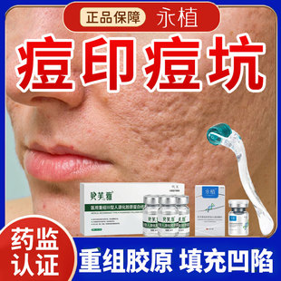 祛除痘坑痘印修复男医用型精华凹洞生长因子填充冻干粉水光滚针YZ