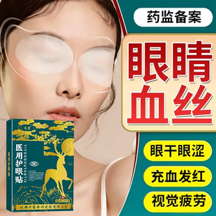 去红血丝抗疲劳眼睛充血眼白发黄清澈去黄冷敷眼贴可搭眼药水用YY