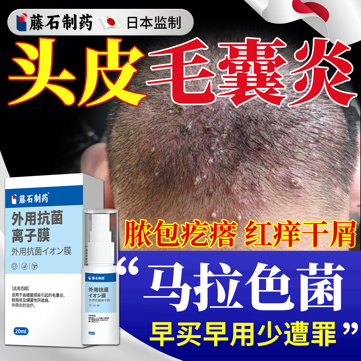 【马拉色菌】头皮毛囊炎脓包疙瘩