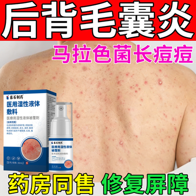 藤石制药后背毛囊炎净痘止痒