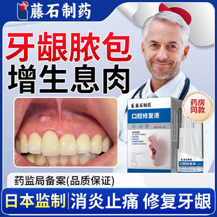 牙龈脓包肿痛消炎专用喷雾剂药房同款治牙根发炎肿包肿痛增生YZ