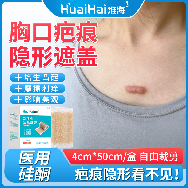 胸口疤痕增生凸起隐形贴遮瑕医用硅凝胶神器痒去除疙瘩修复遮盖WQ