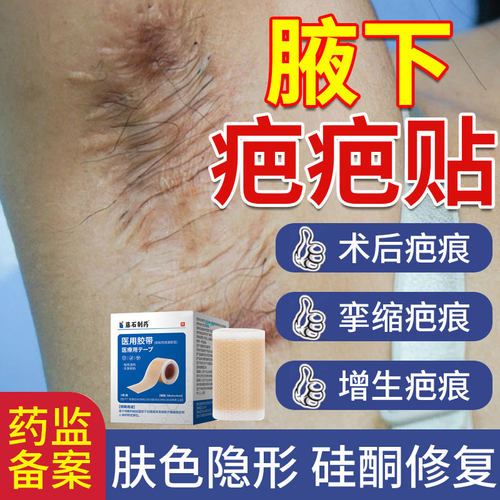 淮海医用硅凝胶带腋下疤痕隐形贴