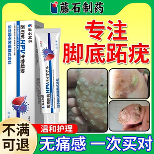 跖疣专用膏去足部病毒根脚上长脚底拓趾石跎疣蚩尤药房同款膏YS
