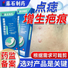 点痣后去增生疤痕修红印凸起复去除疙瘩除疤第一名祛疤贴非膏EK