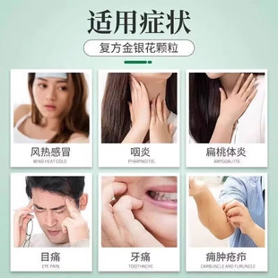 正品复方金银花颗粒成人儿童风热感冒药咽炎牙痛消炎扁桃体炎诺金