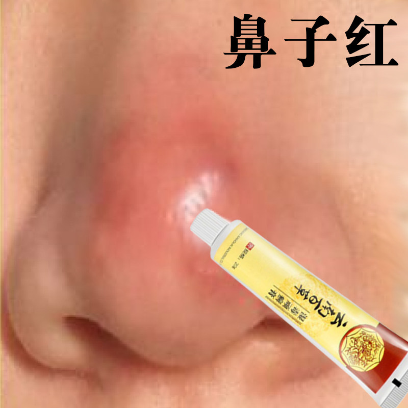 鼻子红肿红鼻头红肿脓包螨鼻尖发红鼻尖疼痛鼻子